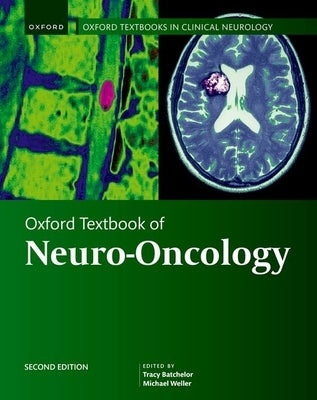 Oxford Textbook of Neuro-Oncology by Batchelor, Tracy