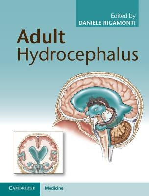 Adult Hydrocephalus by Rigamonti, Daniele