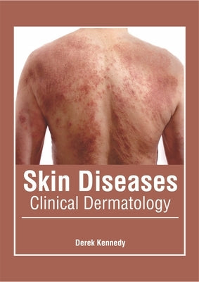 Skin Diseases: Clinical Dermatology by Kennedy, Derek