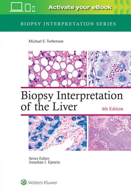 Biopsy Interpretation of the Liver by Torbenson, Michael