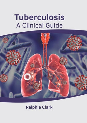 Tuberculosis: A Clinical Guide by Clark, Ralphie