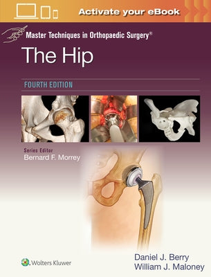 Master Techniques in Orthopaedic Surgery: The Hip: Print + eBook with Multimedia by Berry, Daniel John