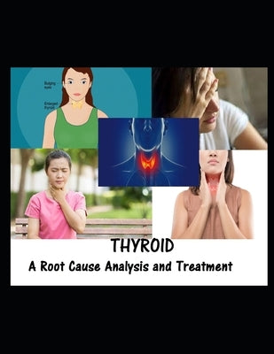 Thyroid: A Root Cause Analysis and Treatment by Kiran, Ravi