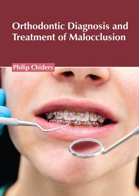 Orthodontic Diagnosis and Treatment of Malocclusion by Chiders, Philip