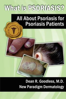 What is Psoriasis?: All About Psoriasis for Psoriasis Patients by Goodless MD, Dean R.