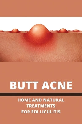 Butt Acne: Home And Natural Treatments For Folliculitis: Barber'S Itch Home Remedies by Kua, Dalila