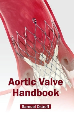 Aortic Valve Handbook by Ostroff, Samuel