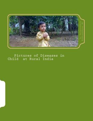 Pictures of Diseases in Child at Rural India by Mukhopadhyay, Rajatsubhra
