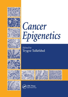 Cancer Epigenetics by Tollefsbol, Trygve