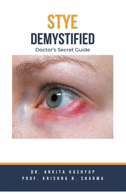 Stye Demystified: Doctor's Secret Guide by Kashyap, Ankita