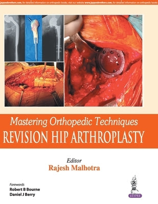 Mastering Orthopedic Techniques: Revision Hip Arthroplasty by Malhotra, Rajesh