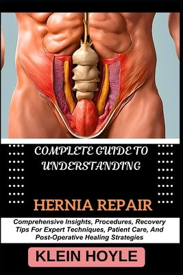 Complete Guide to Understanding Hernia Repair: Comprehensive Insights, Procedures, Recovery Tips For Expert Techniques, Patient Care, And Post-Operati by Hoyle, Klein
