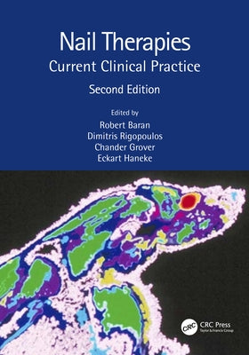 Nail Therapies: Current Clinical Practice by Baran, Robert