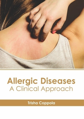 Allergic Diseases: A Clinical Approach by Coppola, Trisha