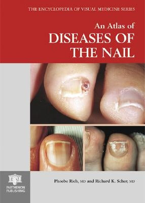 An Atlas of Diseases of the Nail by Rich, Phoebe