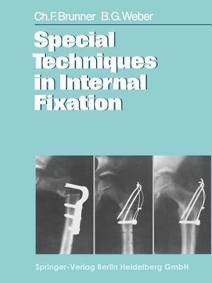 Special Techniques in Internal Fixation by Brunner, C. F.