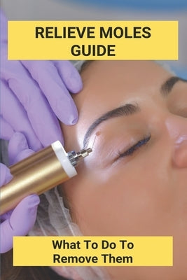 Relieve Moles Guide: What To Do To Remove Them: Getting Rid Of Moles In The Yard by Findlay, Lorean