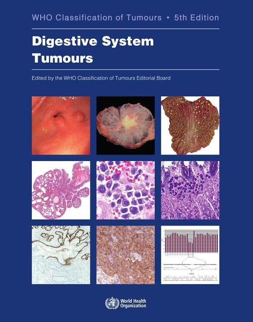 Digestive System Tumours: Who Classification of Tumours by Who Classification of Tumours Editorial