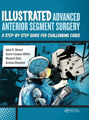 Illustrated Advanced Anterior Segment Surgery: A Step-by-Step Guide for Challenging Cases by Ahmed, Iqbal