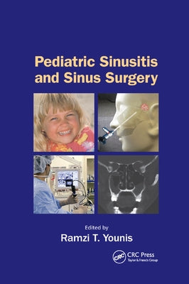 Pediatric Sinusitis and Sinus Surgery by Younis, Ramzi T.