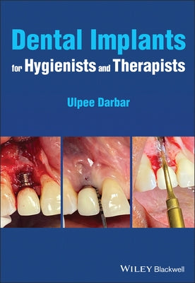 Dental Implants for Hygienists and Therapists by Darbar, Ulpee R.
