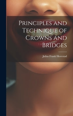 Principles and Technique of Crowns and Bridges by Hovestad, Julius Frank