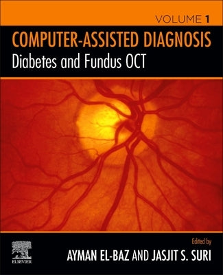 Diabetes and Fundus Oct by S. El-Baz, Ayman