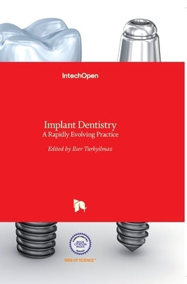 Implant Dentistry: A Rapidly Evolving Practice by Turkyilmaz, Ilser