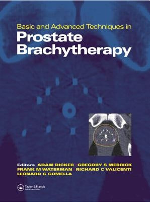 Basic and Advanced Techniques in Prostate Brachytherapy by Dicker, Adam P.