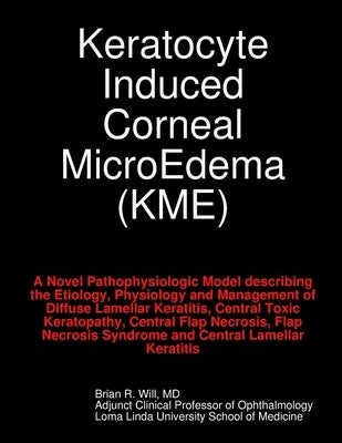 Keratocyte Induced Corneal MicroEdema by Will, Brian