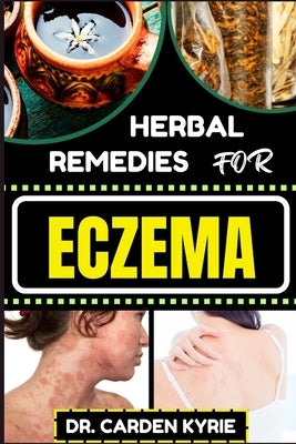 Herbal Remedies for Eczema: Unlocking Nature's Healing Power With Herbs For Flourishing Skin, Holistic Wellness, Lasting Relief And Healthy Lifest by Kyrie, Carden
