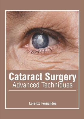 Cataract Surgery: Advanced Techniques by Fernandez, Lorenzo