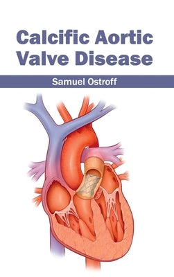 Calcific Aortic Valve Disease by Ostroff, Samuel