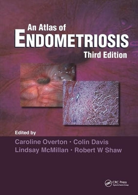 Atlas of Endometriosis by Overton, Caroline