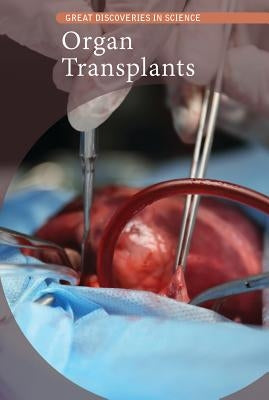 Organ Transplants by Small, Cathleen