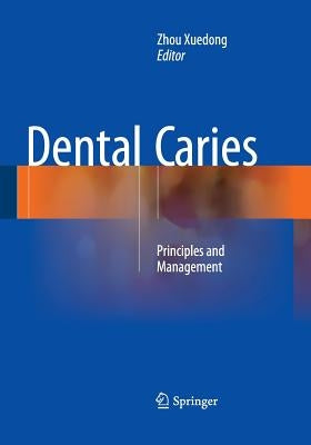 Dental Caries: Principles and Management by Xuedong, Zhou
