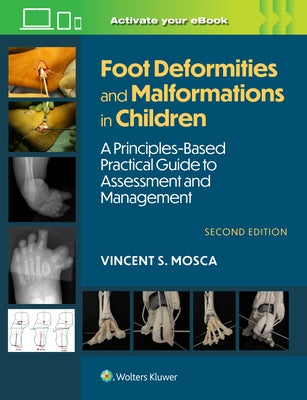 Foot Deformities and Malformations in Children: A Principles-Based, Practical Guide to Assessment and Management: Print + eBook with Multimedia by Mosca, Vincent