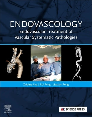 Endovascology: Endovascular Treatment of Vascular Systematic Pathologies by Jing, Zaiping