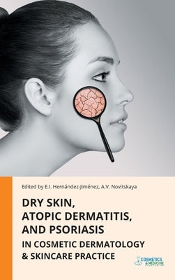 Dry Skin, Atopic Dermatitis, and Psoriasis in Cosmetic Dermatology & Skincare Practice by Hernandez-Jimenez, Elena