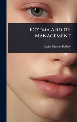 Eczema And Its Management by Bulkley, Lucius Duncan