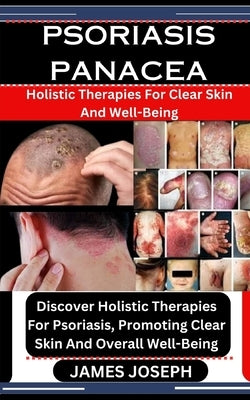 Psoriasis Panacea: Holistic Therapies For Clear Skin And Well-Being: Discover Holistic Therapies For Psoriasis, Promoting Clear Skin And by Joseph, James