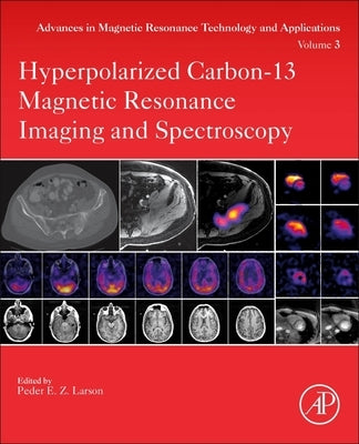 Hyperpolarized Carbon-13 Magnetic Resonance Imaging and Spectroscopy: Volume 3 by Larson, Peder