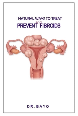 Natural Ways to Treat and Prevent Fibroids by Olukoy, Bayo Joe