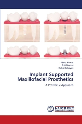 Implant Supported Maxillofacial Prosthetics by Kumar, Manoj
