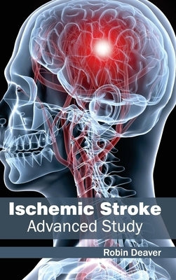 Ischemic Stroke: Advanced Study by Deaver, Robin