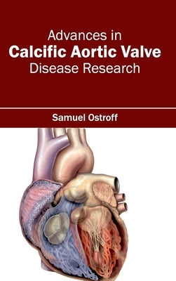 Advances in Calcific Aortic Valve Disease Research by Ostroff, Samuel
