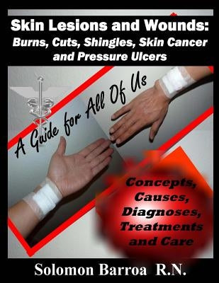 Skin Lesions and Wounds: Burns, Cuts, Shingles, Skin Cancer and Pressure Ulcer: ( Concepts, Causes, Diagnoses, Treatment and Care ) by Barroa, Solomon