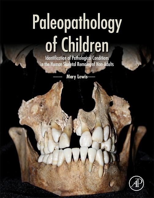 Paleopathology of Children: Identification of Pathological Conditions in the Human Skeletal Remains of Non-Adults by Lewis, Mary
