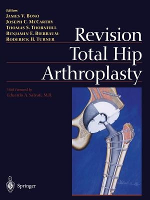 Revision Total Hip Arthroplasty by Bono, James V.