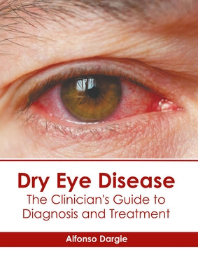 Dry Eye Disease: The Clinician's Guide to Diagnosis and Treatment by Dargie, Alfonso